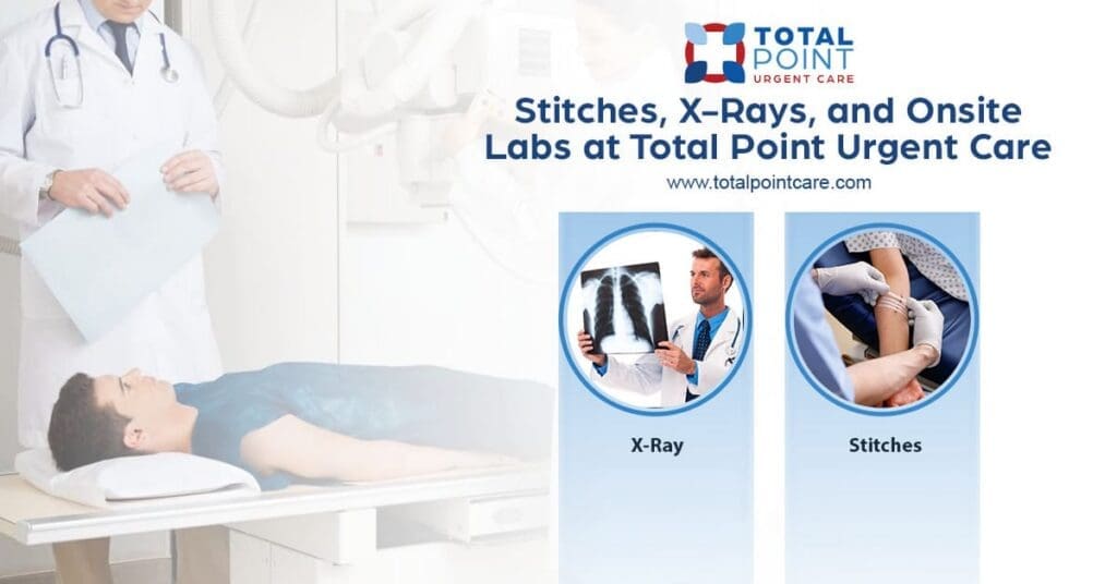 Stitches, X-Rays, and Onsite Labs at Total Point Urgent Care