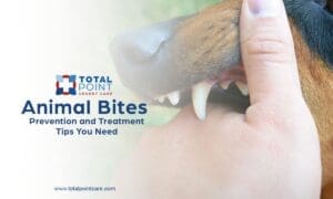 What to Do if Bitten by an Animal: Prevention, Treatment, and Rabies Risks