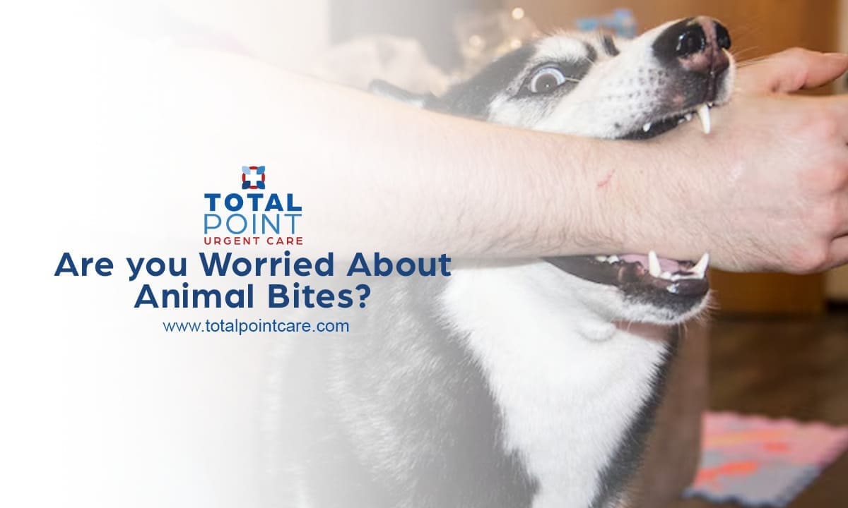 Are you Worried About Animal Bites?