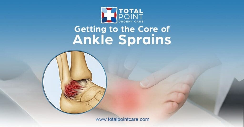 Getting to the Core of Ankle Sprains: Causes, Care & Recovery Explained