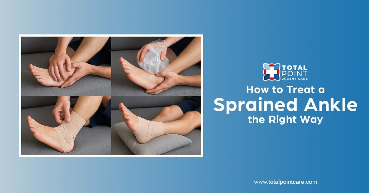 How to Treat a Sprained Ankle the Right Way