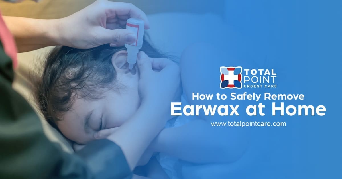 How to Safely Remove Earwax at Home