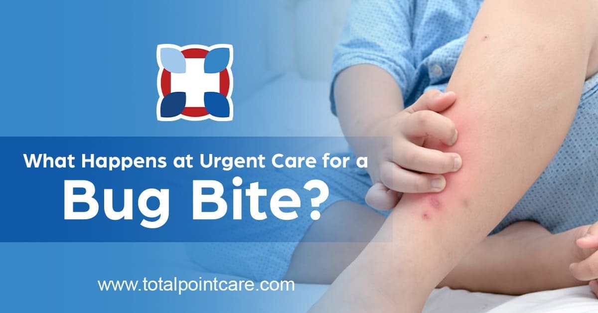 What Happens at Urgent Care for a Bug Bite?