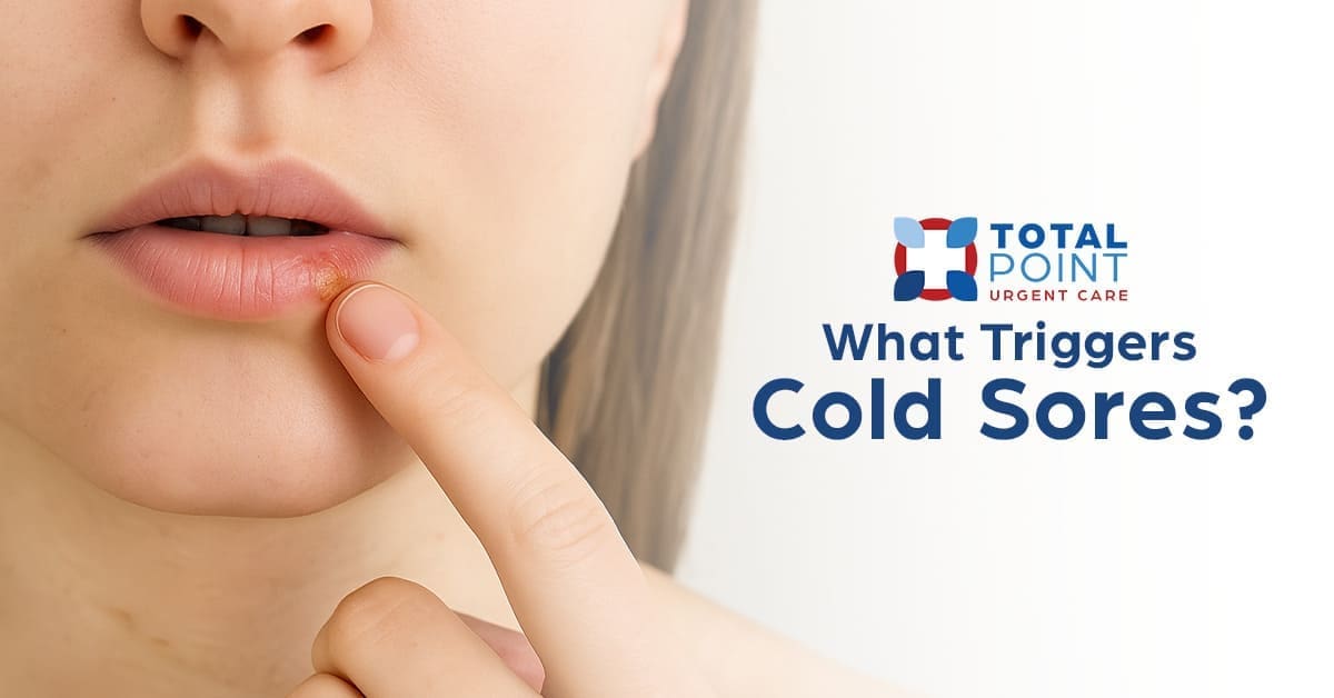 What Triggers Cold Sores?
