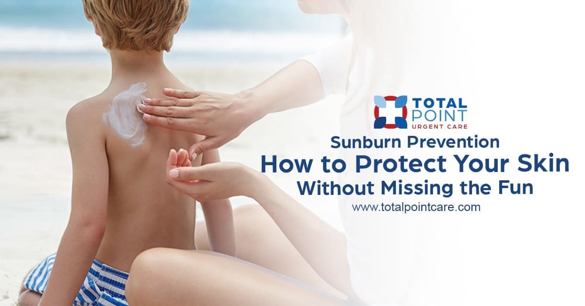 Sunburn Prevention: How to Protect Your Skin Without Missing the Fun