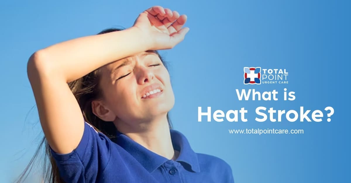 What is Heat Stroke?