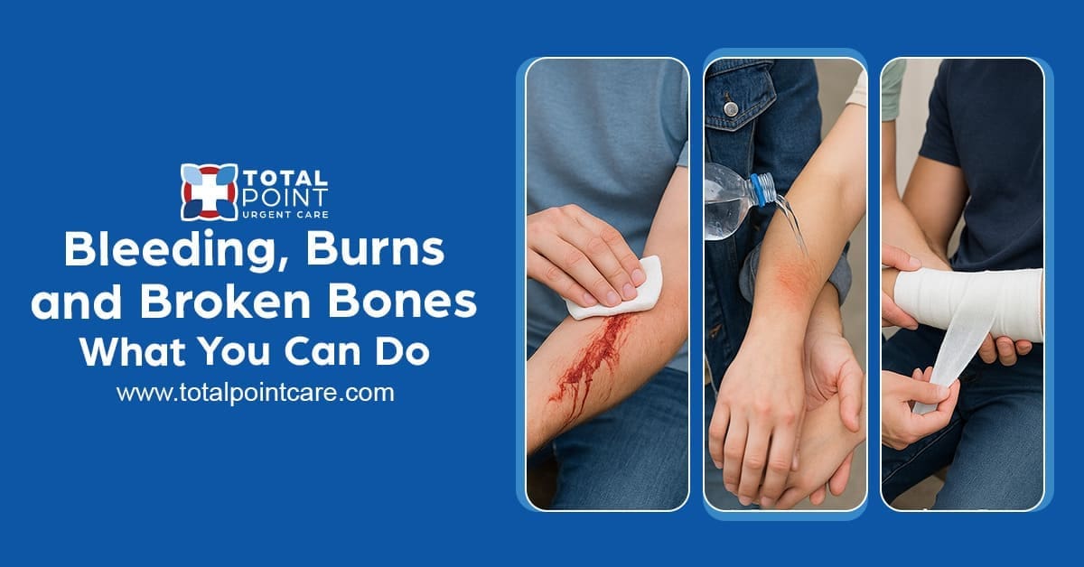 Bleeding, Burns, and Broken Bones: What You Can Do