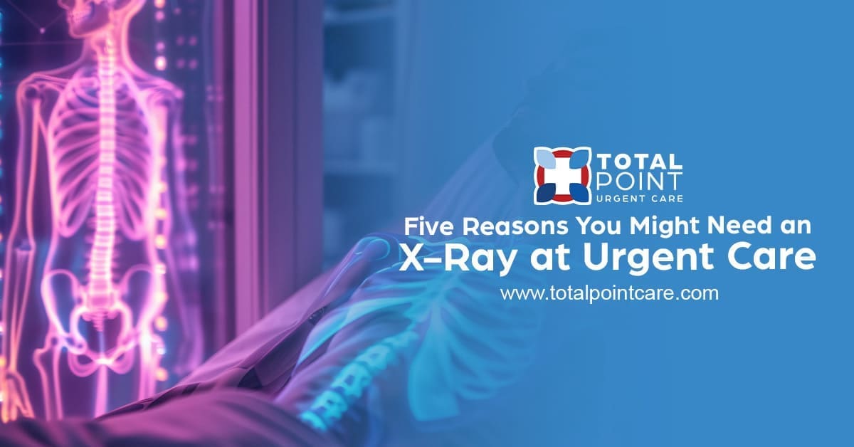 Five Reasons You Might Need an X-Ray at Urgent Care