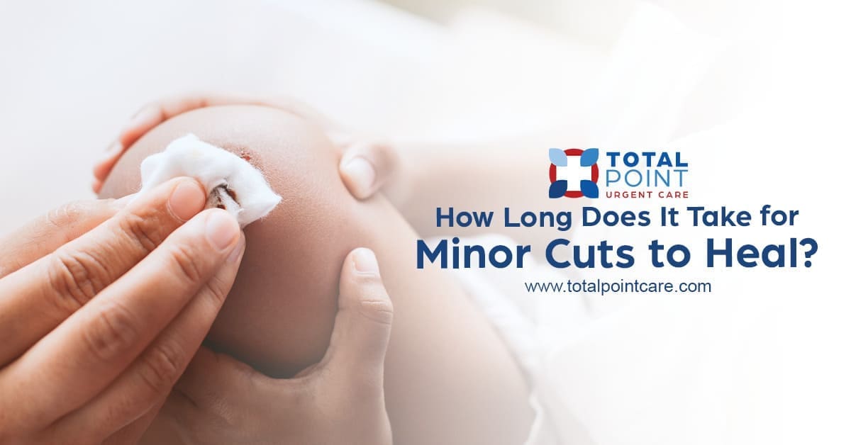 How Long Do Minor Cuts Take to Heal?