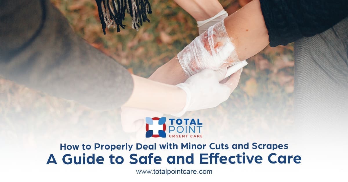 How to Properly Deal with Minor Cuts and Scrapes: A Guide to Safe and Effective Care