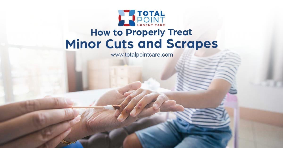 How to Take Care of Minor Cuts and Scrapes??