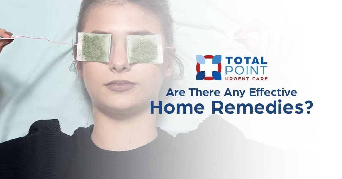 Supportive Care at Home for All Types of Conjunctivitis: