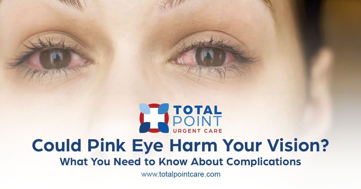 Can Pink Eye Cause Vision Damage? Complications & When to See a Doctor