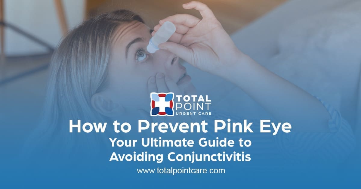 How to Prevent Pink Eye: Essential Tips to Keep Your Eyes Safe