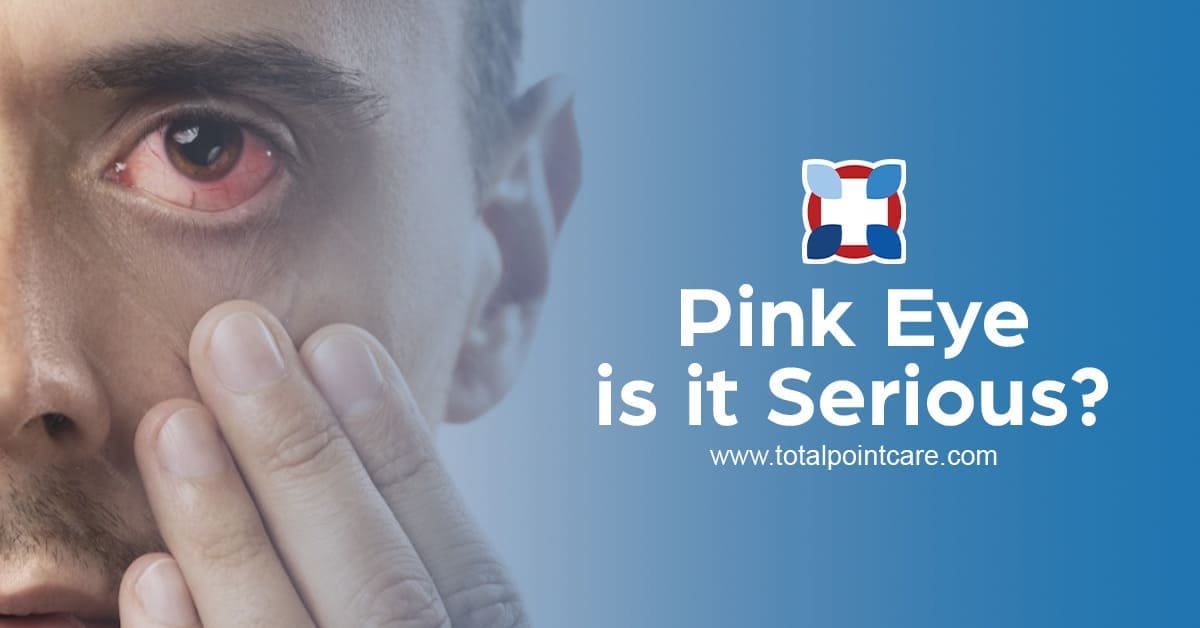 Is Pink Eye Serious